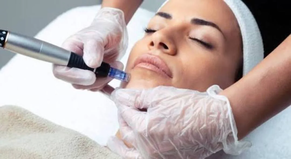 Dermapen Facial