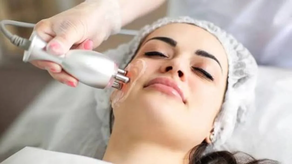Radiofrecuencia facial